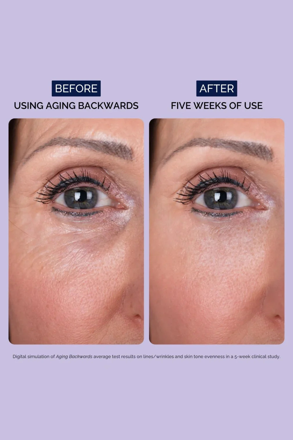 Before and after close-up of woman's eye showing reduced wrinkles using Aging Backwards retinol cream