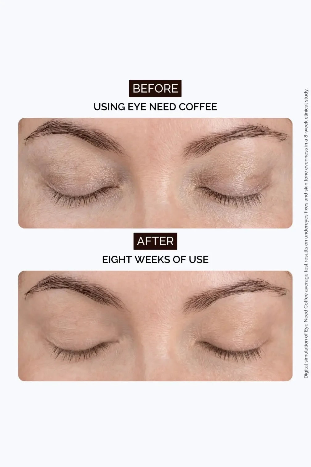 Before and after eye area photos showing results of Eye Need Coffee cream after eight weeks