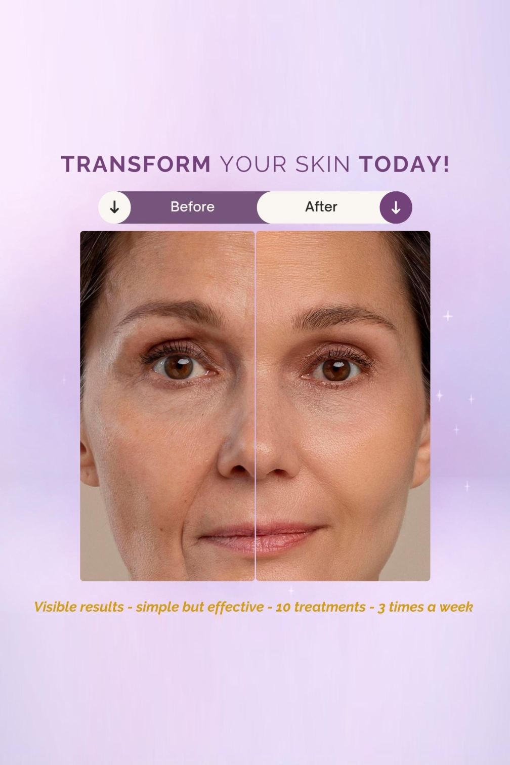 Led light Face Therapy Mask