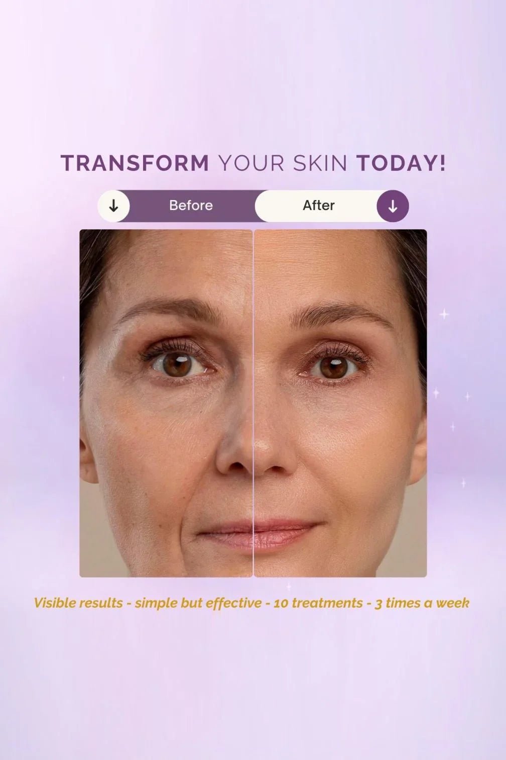 Skinimalist™ LED Light Mask Clinical Light Therapy • Asian - Skin Brightening • FDA - Cleared - Sabbskin